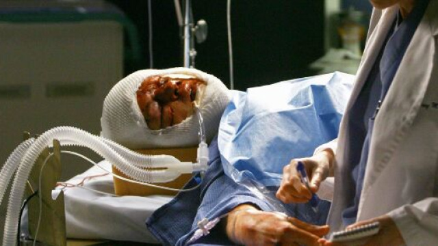 Nella sesta stagione di Grey's Anatomy, George O'Malley muore in seguito alle gravi ferite riportate in un incidente stradale.