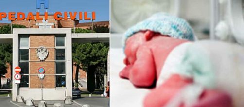 Brescia, resta incinta dopo l'intervento di sterilizzazione: lo Spedali Civili di Brescia dovrà mantenere la bambina.