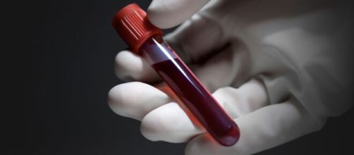 Un nuevo análisis de sangre puede detectar 5 tipos de cáncer mucho antes que las pruebas convencionales