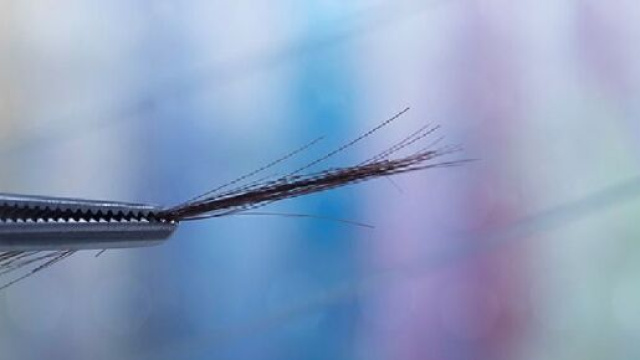 Dosare l'ormone anti-M&uuml;lleriano (AMH) nei capelli &egrave; pi&ugrave; accurato e meno invasivo rispetto al dosaggio ematico.