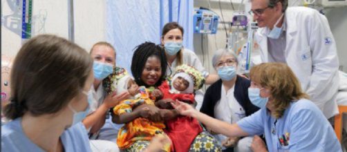 Dos niñas gemelas que nacieron unidas por el cráneo fueron separadas exitosamente en el hospital pediátrico de Roma Bambino Gesù.