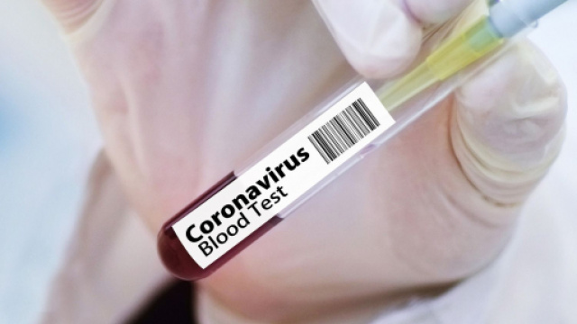 Test sierologici Covid-19 per insegnanti e bidelli.