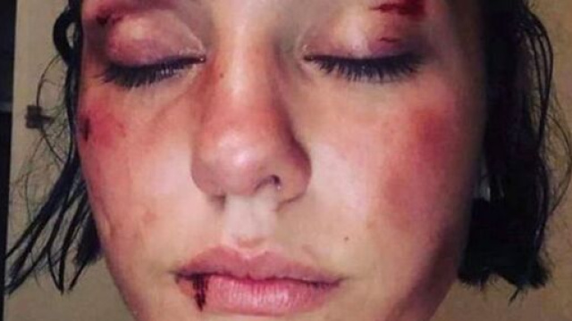 La jeune fille a publié les images de son agression sur les réseaux sociaux, source : capture Twitter - France 3 Occitanie