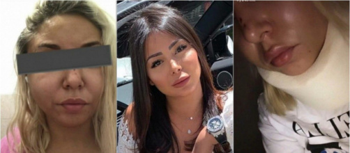 Les Marseillais vs Le Reste du Monde 5 : Maeva Ghennam alcoolisée en soirée, elle aurait envoyé deux personnes à l'hôpital.