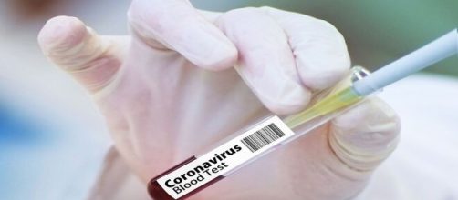 La vacuna rusa contra el coronavirus debería distribuirse mundialmente desde octubre. Foto: Pixabay