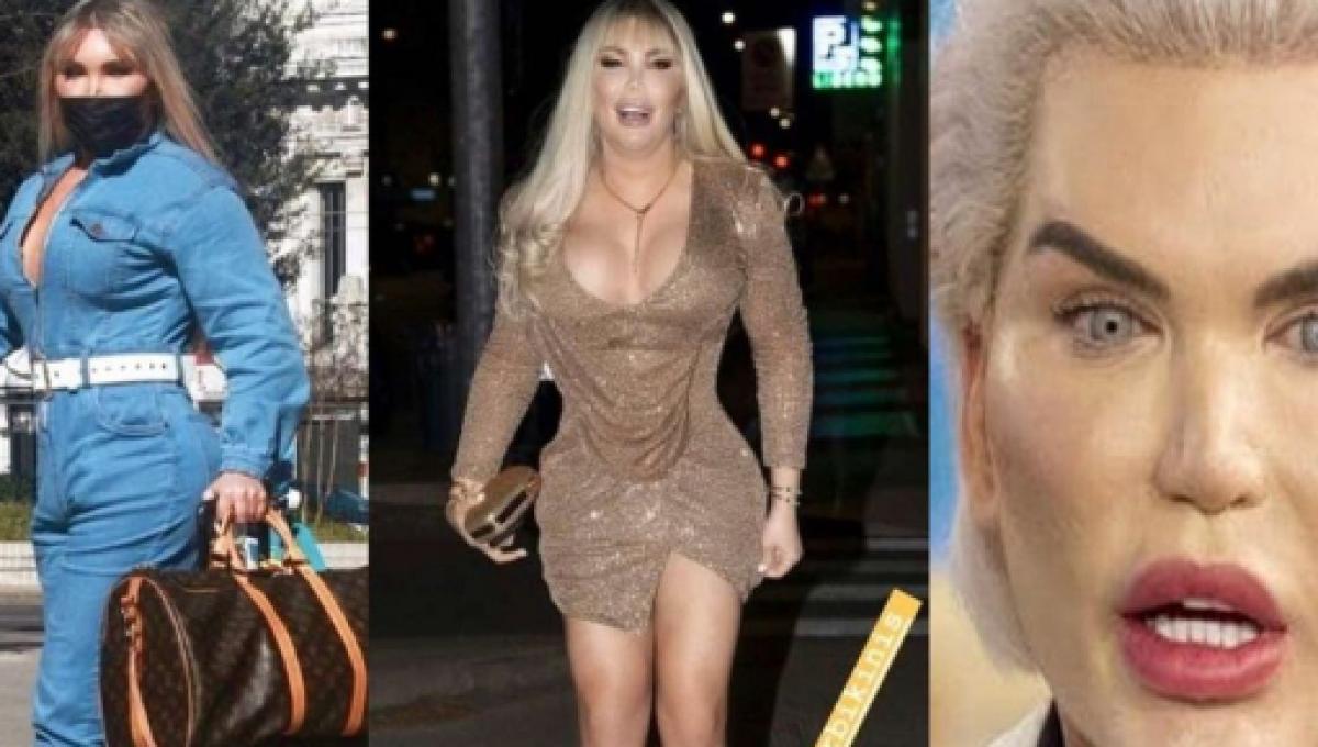 Ex Ken Humano Passa Por Transicao De Genero E Mostra Mudancas Radicais Aos Fas