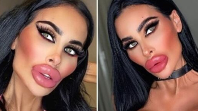 ACCRO À LA CHIRURGIE, ELLE S’EST FAIT REFAIRE 5 FOIS LA POITRINE ET NE COMPTE PAS S’ARRÊTER LÀ - photo capture d'écran Facebook