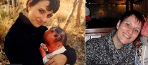 LE BÉBÉ, ATTEINT D’UNE MALADIE DE PEAU RARE, A MAINTENANT 27 ANS (PHOTOS) - photo facebook
