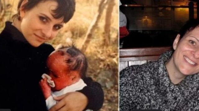 LE BÉBÉ, ATTEINT D’UNE MALADIE DE PEAU RARE, A MAINTENANT 27 ANS (PHOTOS) - photo facebook