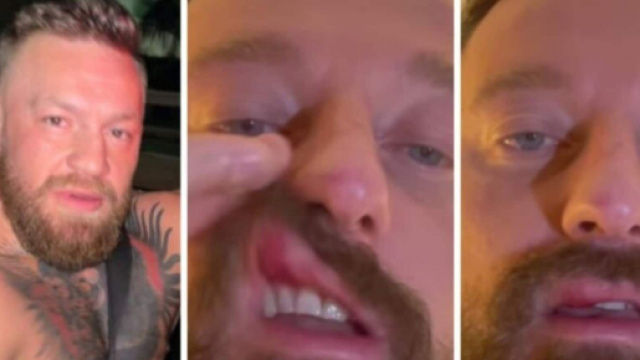 Francesco Facchinetti shock: "Conor McGregor mi ha picchiato" - corrieredellosport.it