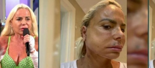 Leticia Sabater tiene un largo historial de operaciones estéticas a sus 55 años. (Captura de pantalla)