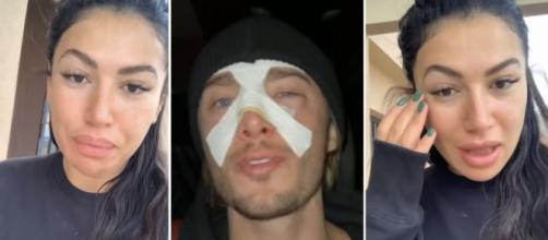 Un accident en plein voyage humanitaire au Maroc pour Dylan Thiry qui se retrouve avec le nez complètement cassé- Source : montage, Blasting News