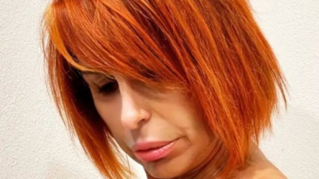 Uomini e Donne, Luisa dopo l'operazione e la terapia: 'Sono così, senza filtri' (FOTO).