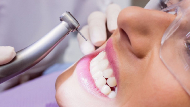 Detartrasi: l’importanza di togliere il tartaro per avere denti in salute.