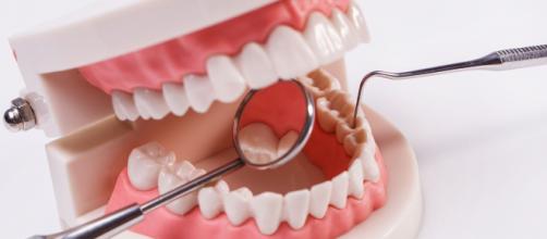 Dentiere: tipologie e costi degli impianti totali o parziali.