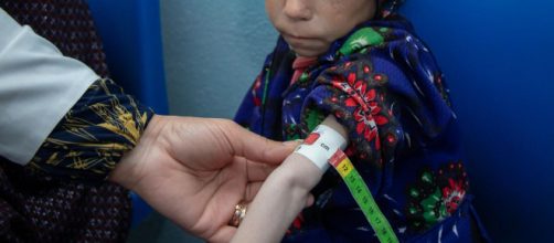 One million Afghan children could starve to death in the winter of 2021-2022 (Image source: UNICEF Afghanistan)
