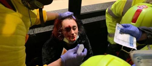 Pierde el ojo la mujer herida supuestamente por los Mossos en la protesta por Hasél
