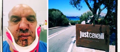 Pietro Paolo Cossu era stato brutalmente aggredito a Porto Cervo.