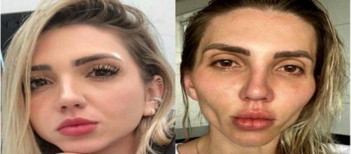 Jéssica Frozza comenta sobre su experiencia con la cirugía estética que le deformo el rostro (@eusoufrozza / Instagram)