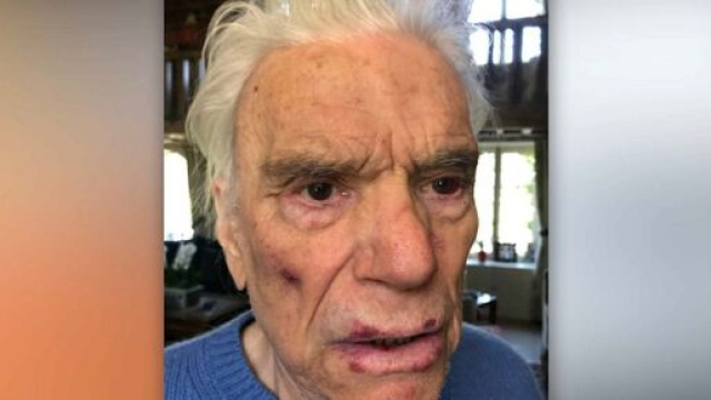 Agression de Bernard et Dominique Tapie : les images dévoilées (Credit Twitter : BFMTV)