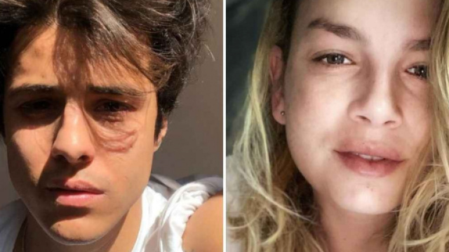 Michele Merlo, ultimo saluto prima dei funerali: anche l'ex coach Emma Marrone a Bologna.