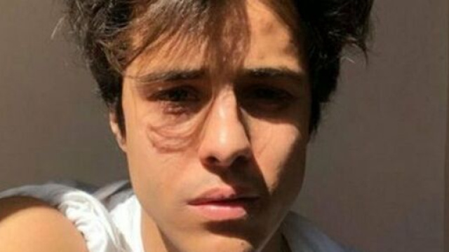 Michele Merlo, il papà: 'Era il nostro unico figlio, zone d'ombra su quanto avvenuto'.