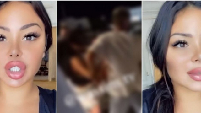 Maeva Ghennam (Les Marseillais vs Le Reste du Monde 6) impliquée dans une violente bagarre à Mykonos, elle s'explique enfin.