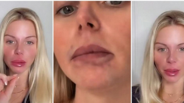 Jessica Thivenin défigurée par sa nouvelle chirurgie esthétique et accusée d'être une mauvaise mère, elle répond à ses haters.