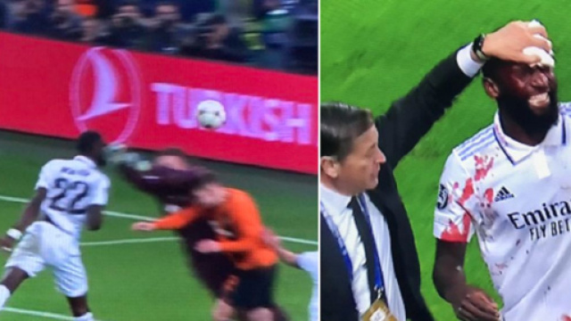 L'incroyable égalisation d'Antonio Rüdiger en sang fait le buzz (capture YouTube)