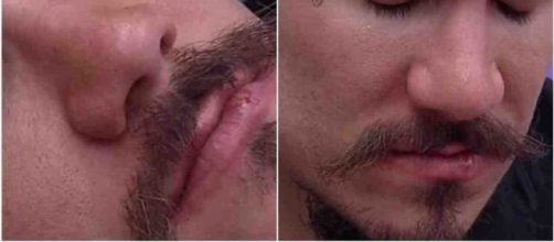 Eliezer foi flagrado com herpes no 'BBB22'. (Fotomontagem)