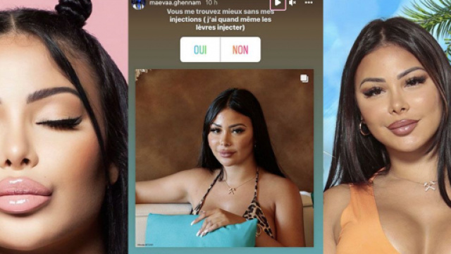 Maeva Ghennam enlève ses injections au visage