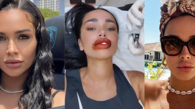 jazz refaite, sa bouche choque les internautes