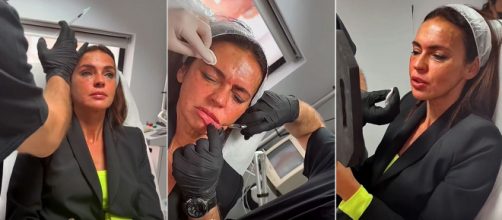 Olga Moreno se somete a un tratamiento estético en el rostro (Capturas Instagram @clinicabruselas)