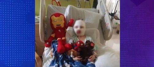 Un niño de 6 años ha sufrido graves quemaduras a manos de otro de 8 (GoFundMe)