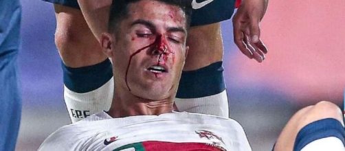 Cristiano Ronaldo en sang après un choc, la vidéo buzze (capture YouTube)