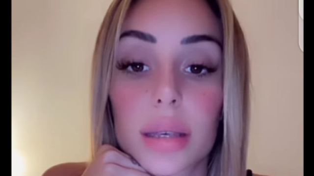 Mélanie explique pourquoi elle a la bouche déformée : feedback sur Greg - blasting news