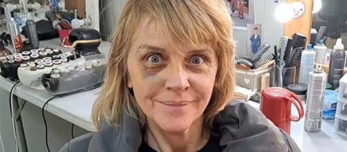 Il Paradiso delle signore, incidente sul set.