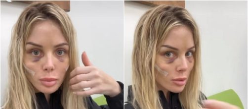 Jessica Thivenin dévoile son visage après son lifting et choque Twitter. (Scrennshots @ Snapchat)