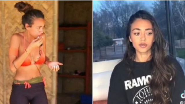 Jessica Errero (Les Apprentis Aventuriers 6) raconte les séquelles de son empoisonnement et publie les photos de sa bouche. (@W9 / TikTok)