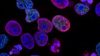 Una vacuna experimental provoca una respuesta inmunitaria contra el cáncer de páncreas, según Nature