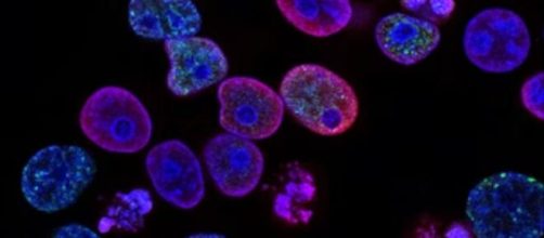 La revista Nature desveló un nuevo avance científico eficaz contra el cáncer de páncreas (Unsplash)