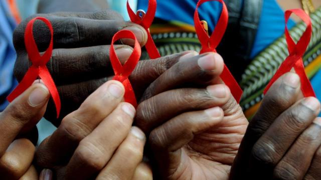 Síntomas que pueden ayudar a diagnosticar si tienes VIH