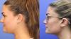 Brittany Cartwright shows how she transformed her chin