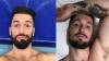5 artistas antes e após aderirem à técnica de harmonização facial