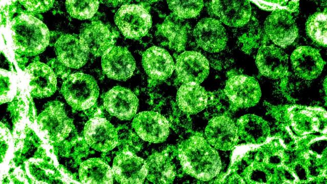 Coronavirus : une quatrième personne est décédée en France