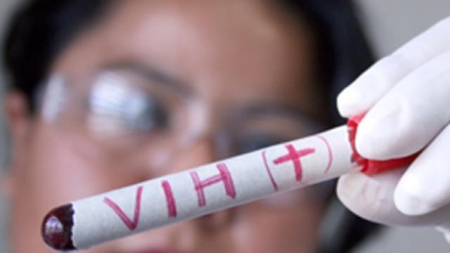 Un paciente en Londres sin signos de VIH después de dos años sin tomar medicamentos