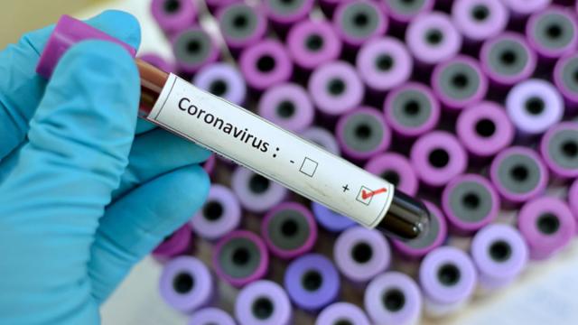 Mais de 100 mil pessoas estão curadas do coronavírus no mundo