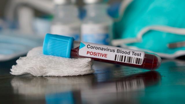 Coronavírus: Complexo do Alemão tem comércio funcionando normalmente