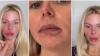 Jessica Thivenin s'affiche avec ses nouvelles lèvres et se fait tacler