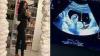 Nehuda de nouveau enceinte, la jeune femme se confie